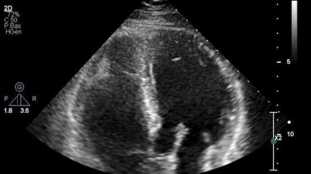 Image échocardiographie report
